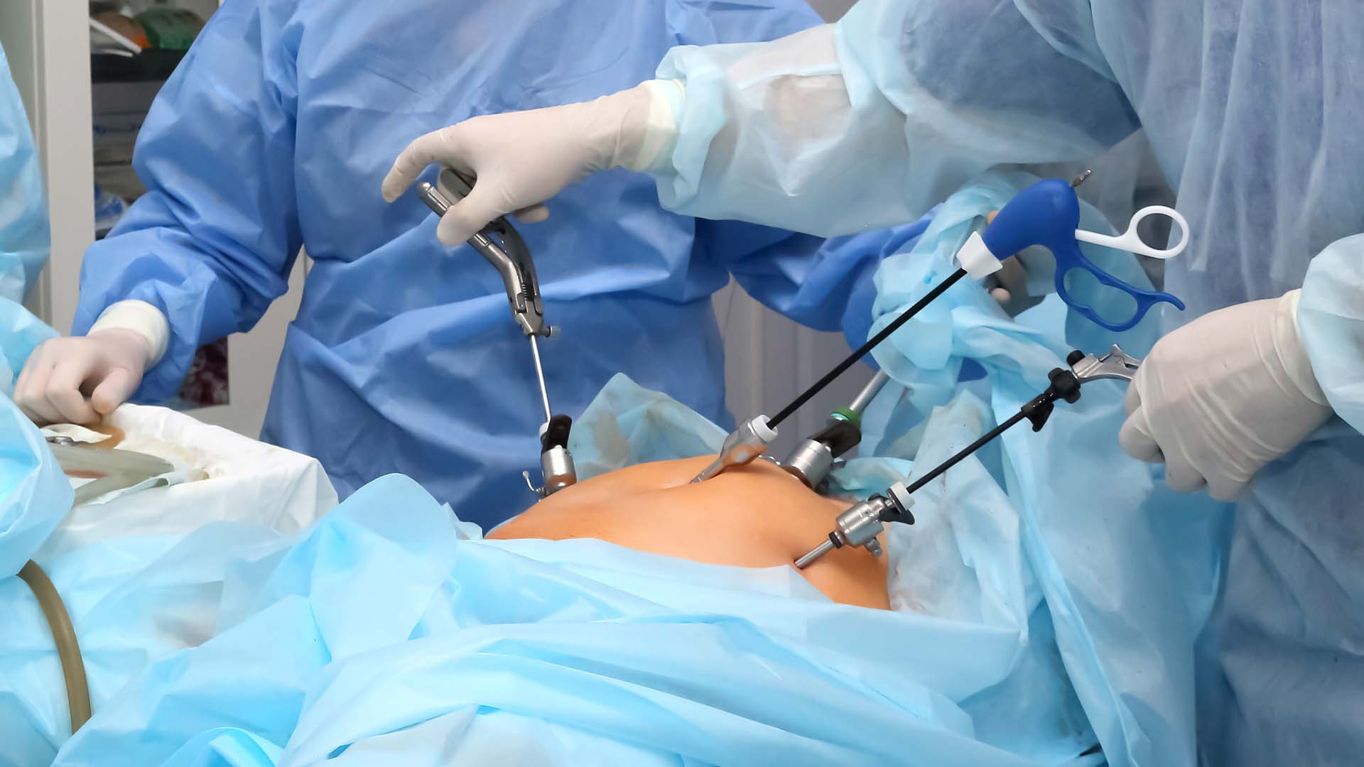 Cirurgia bariátrica está mais segura do que nunca, apontam especialistas
